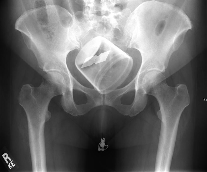 X Ray Cock Inside Pussy