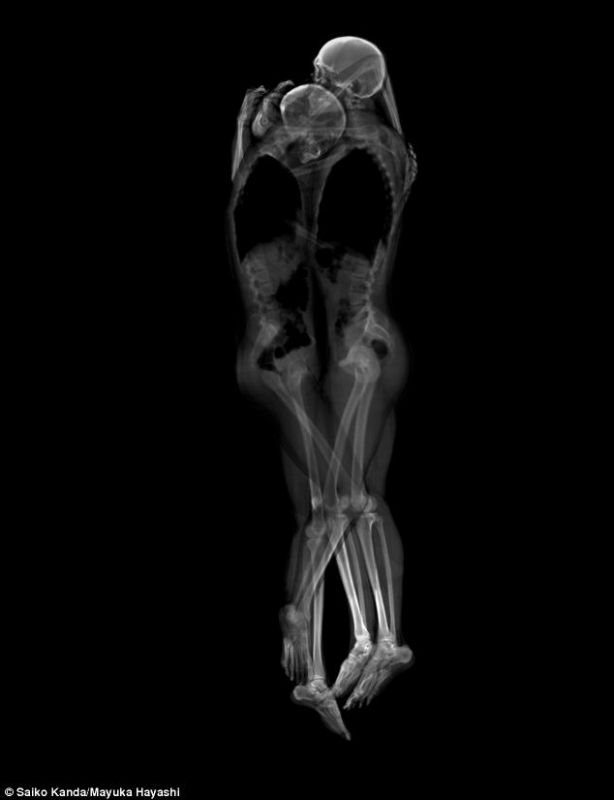 x ray during sex inside body