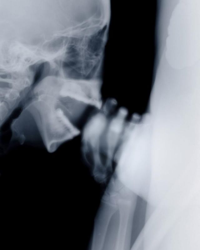 x ray during sex gif