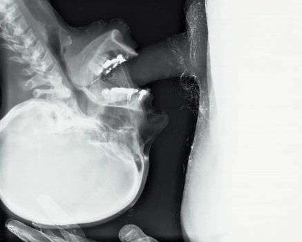 x ray see through dildo sex