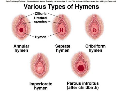 broken hymen sex