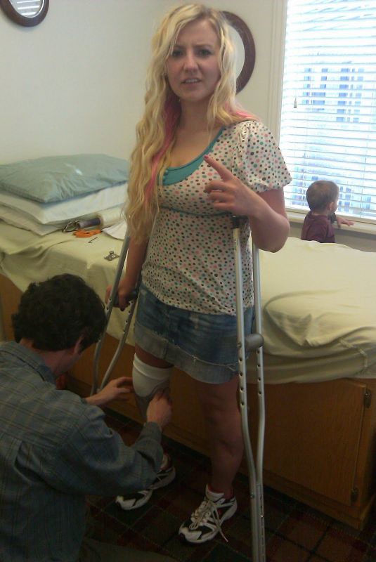 female amputees using crutches