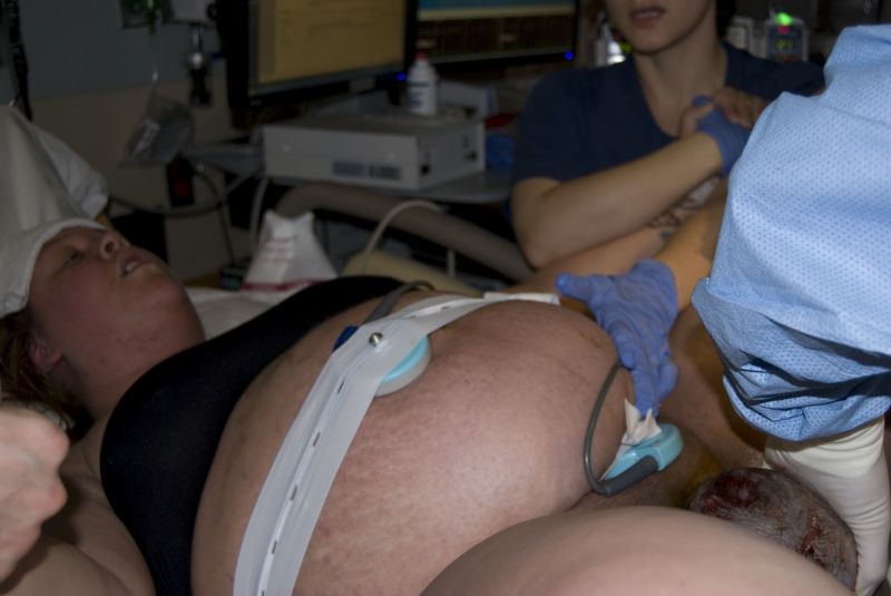 woman vagina while giving birth
