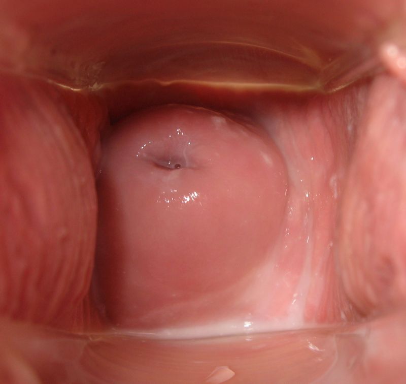 inside view of vagina