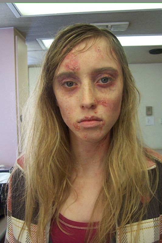 meth teen girl goes vacillation code
