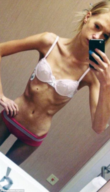 anorexic girl porn