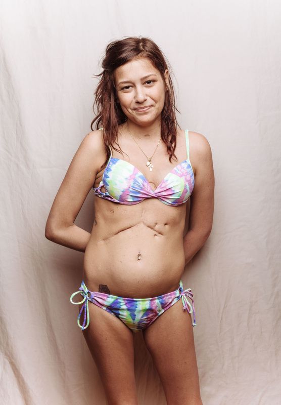 extreme mother daughter bikini