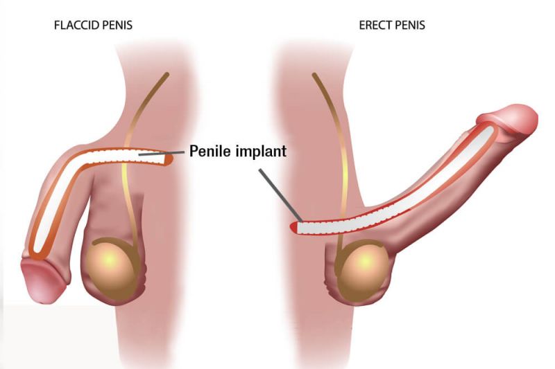 average erect penis
