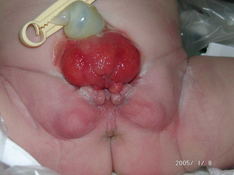 actual female urethra opening