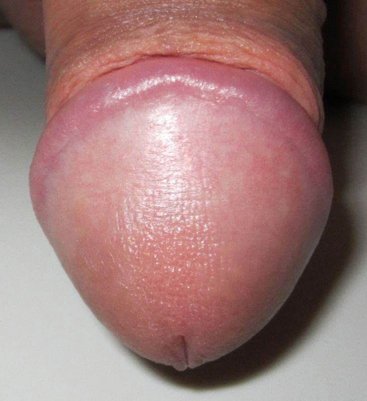female urethra lips