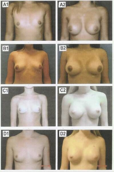 breast sizes smallest to largest