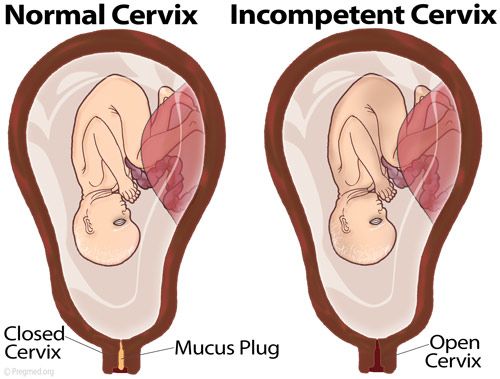 cervix fingering