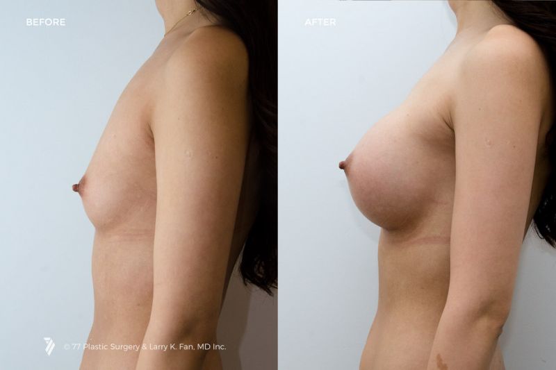 Breast sizes naked
