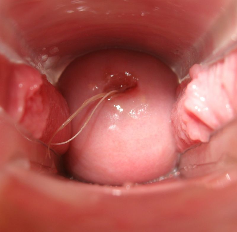 virgin vagina opening