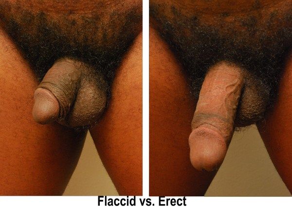 average male penis erect