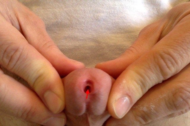 naked vagina clit