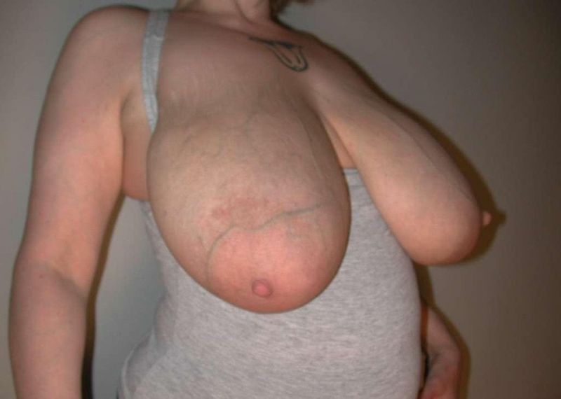 huge boobs