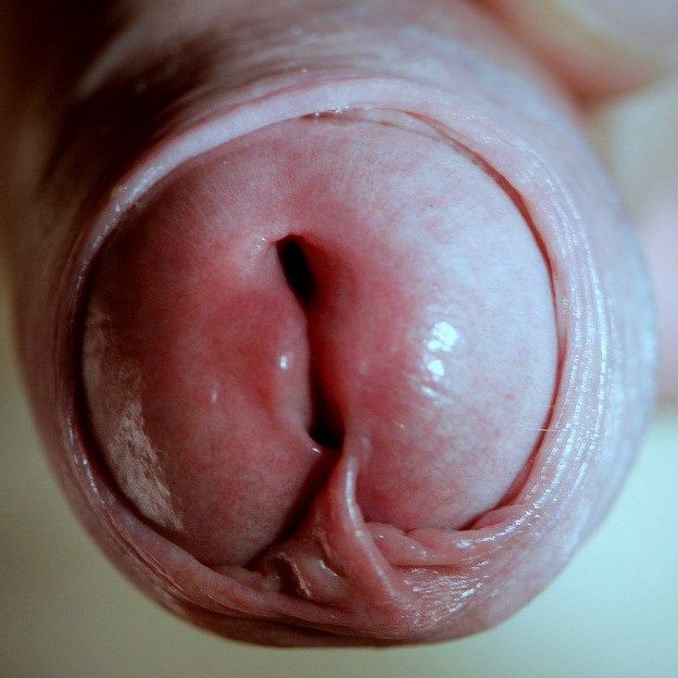 close up dick