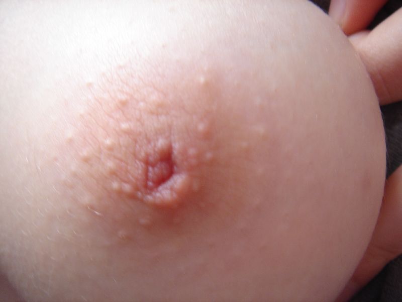 milf erect nipples