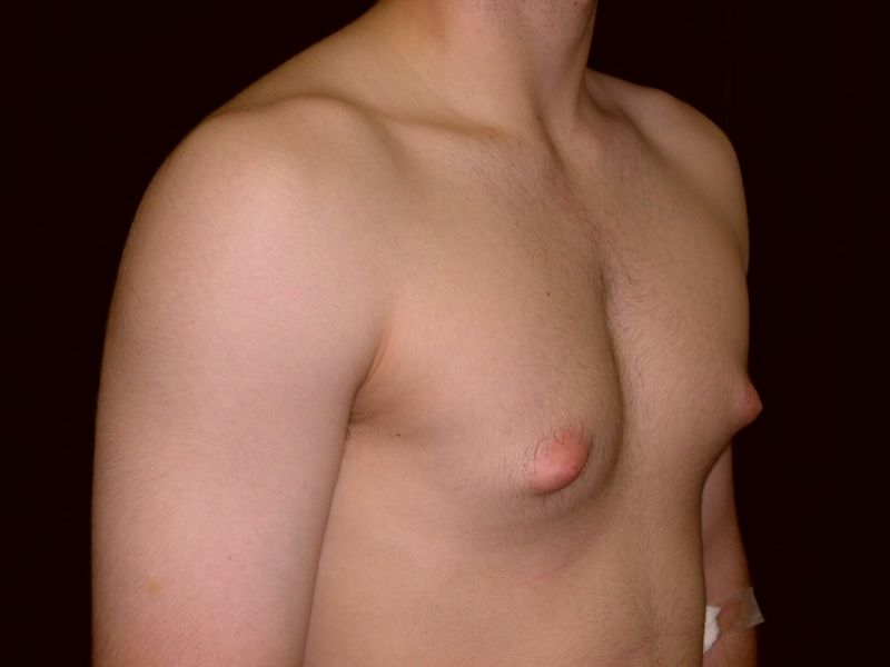 huge breasts puffy nipples