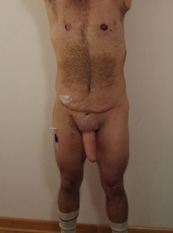 nude male transgender penis