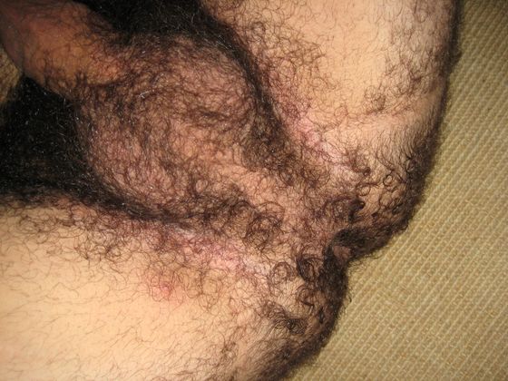 very hairy men butt