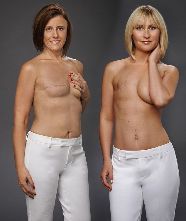 going flat after mastectomy surgery