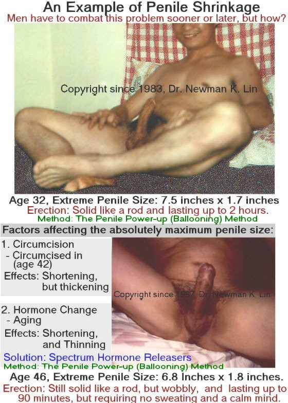testicular shrinkage