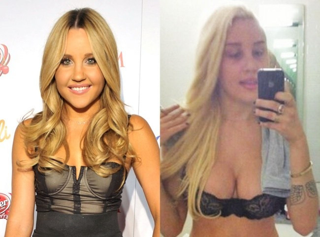 amanda bynes before and after
