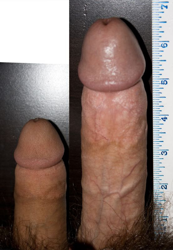 erect penis in ass