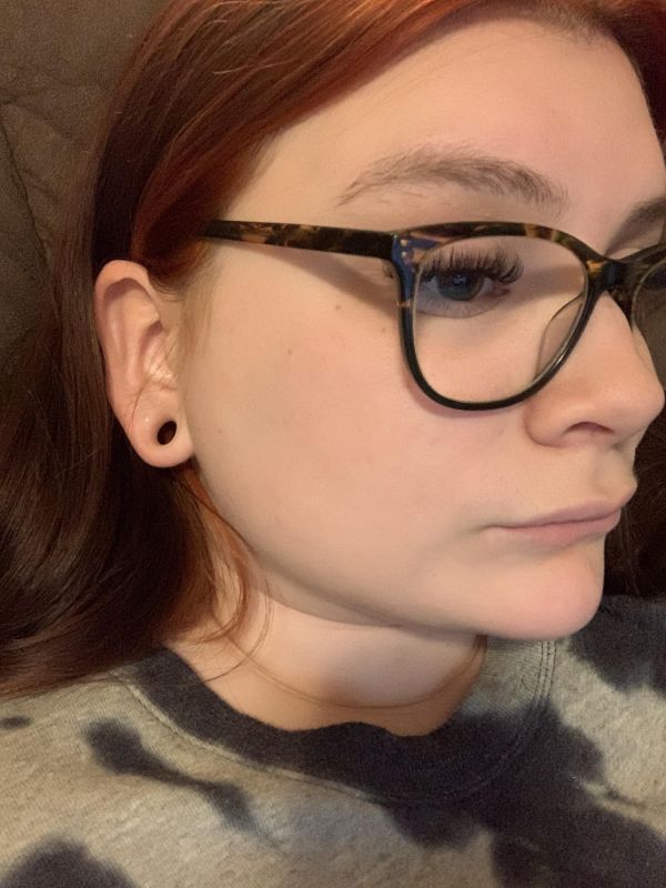 ear surgery