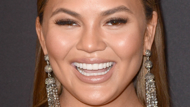 chrissy teigen chin
