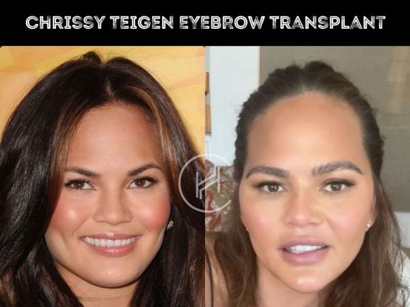 chrissy teigen weight loss before and after