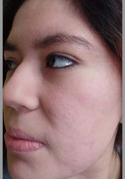 dermatologist