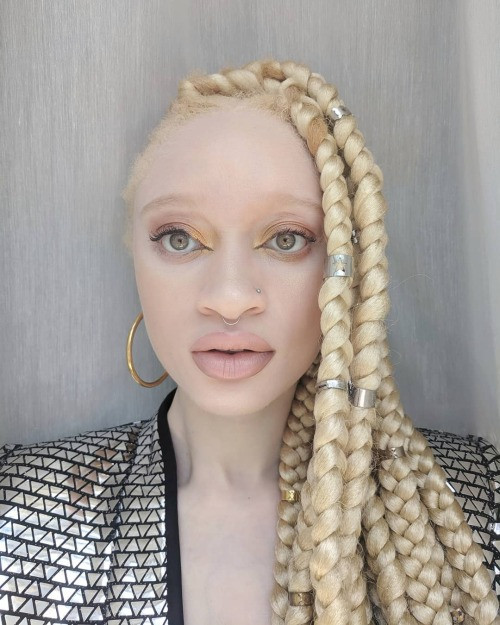 albino color