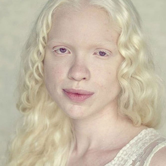 albino cheetah