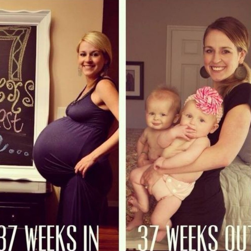 before after identical