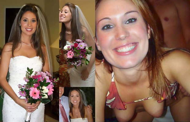 lyma laser before and after acneic skin