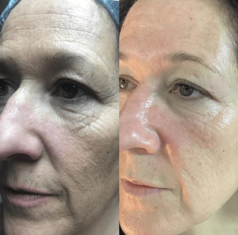 skin texture illustration