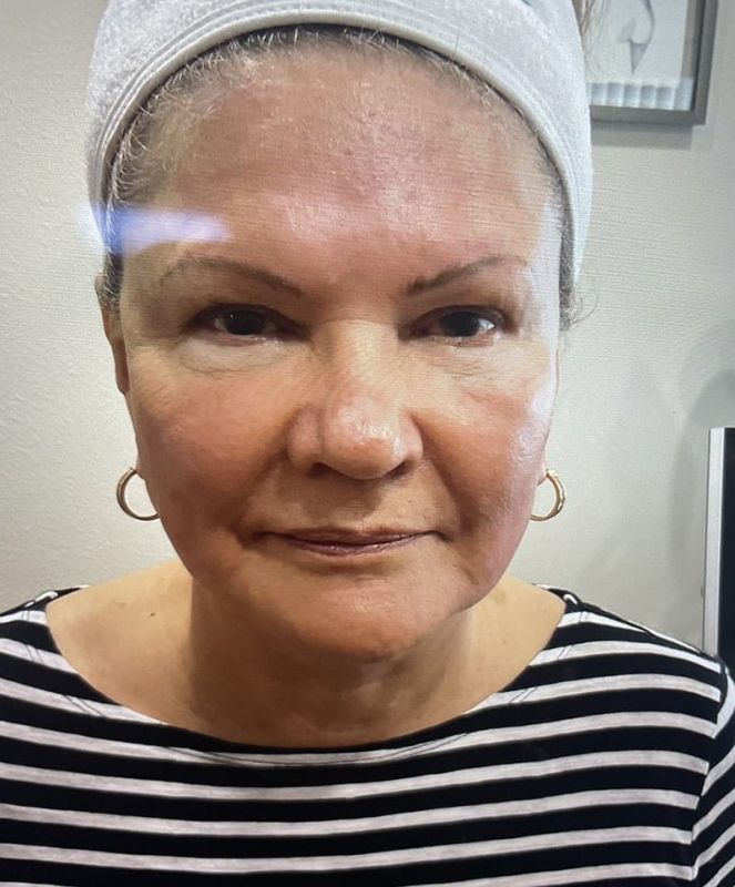 tanning line before and after