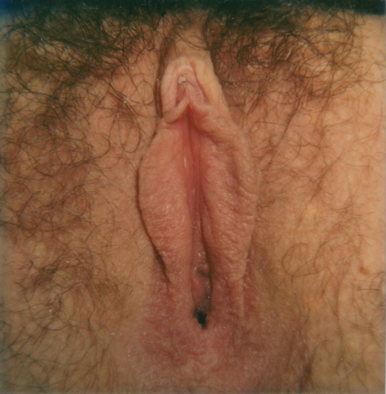hood ring piercing