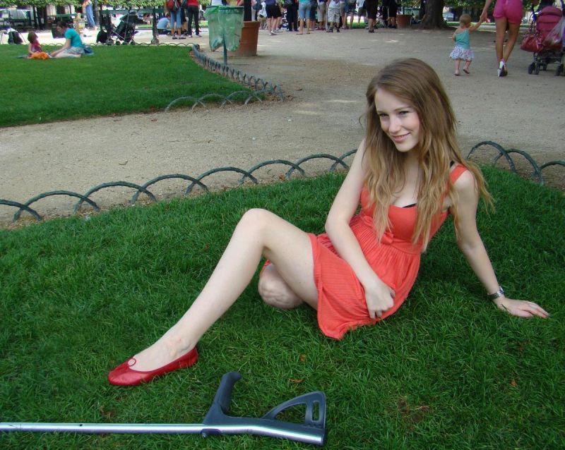 amputees with cute arm stumps