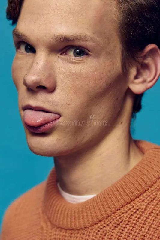 black spots on tongue since birth