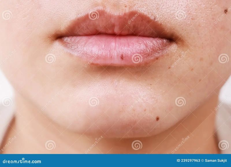 bruised tongue