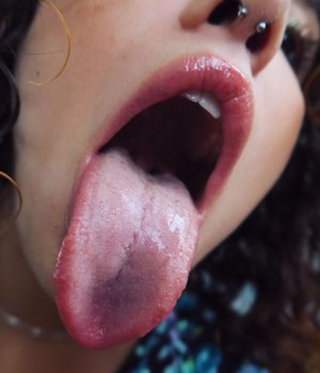 mouth with no tongue