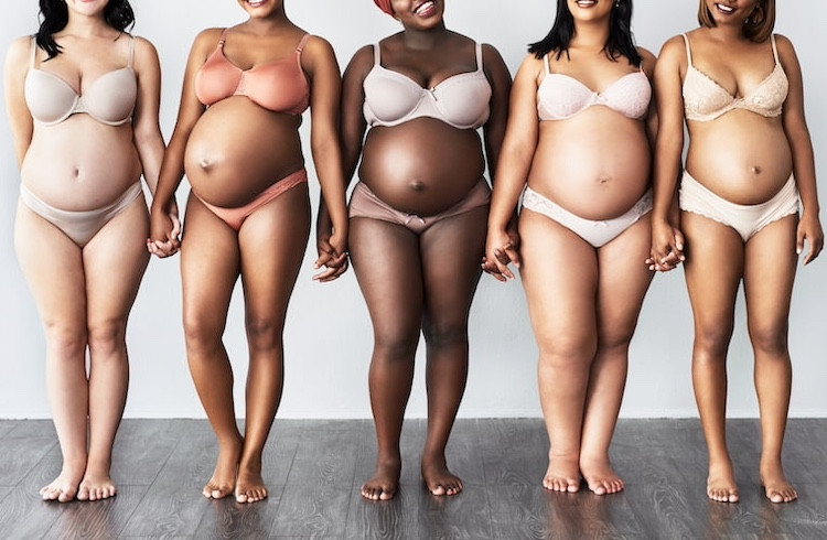 pregnancy stretch marks