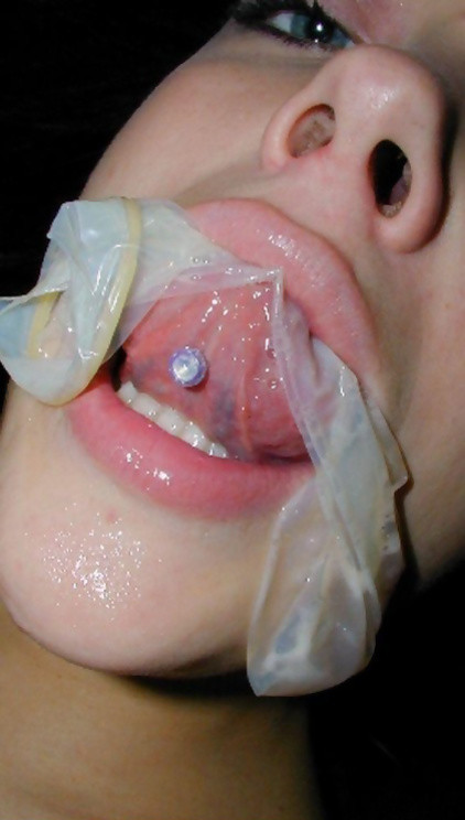 kirby condom