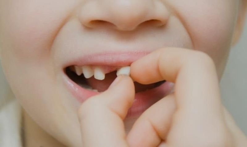 loose teeth